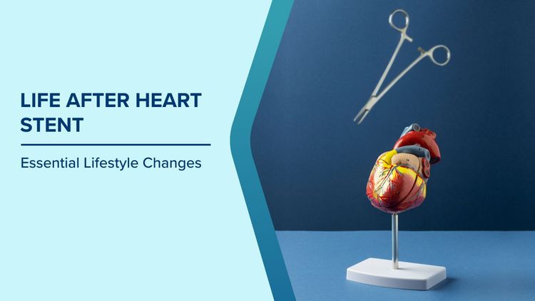 Lifestyle After Heart Stent