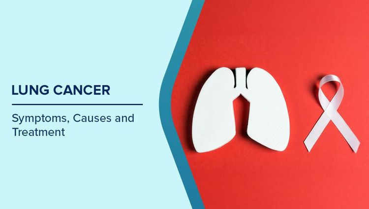 symptoms of lung cancer