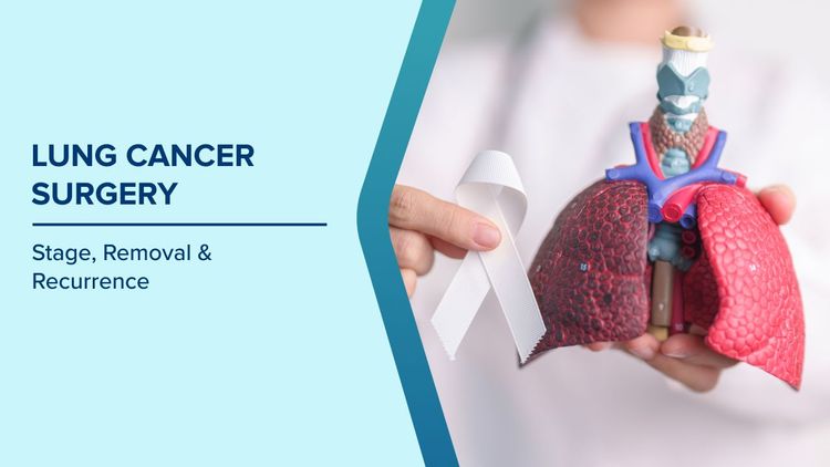 Early-Stage Lung Cancer Surgery