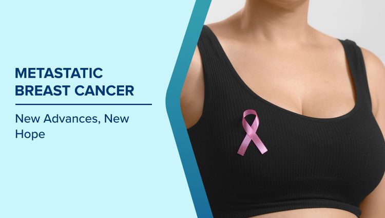 Management of Metastatic Breast Cancer
