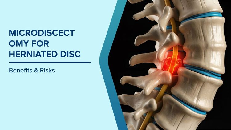 Benefits of Microdiscectomy