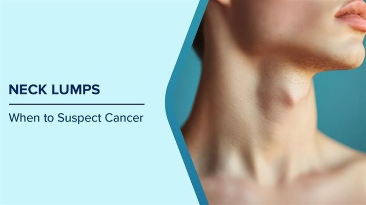 Neck Lump Causes