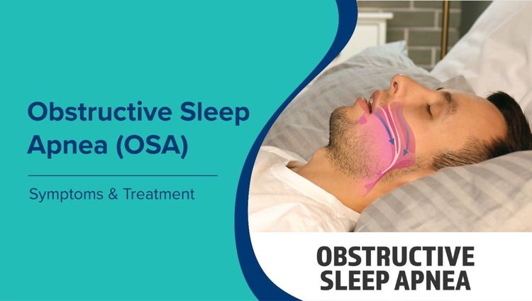 ऑब्सट्रक्टिव स्लीप एपनिया (Obstructive Sleep Apnea in Hindi): लक्षण और इलाज