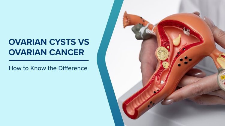 Ovarian Cyst vs Ovarian Cancer