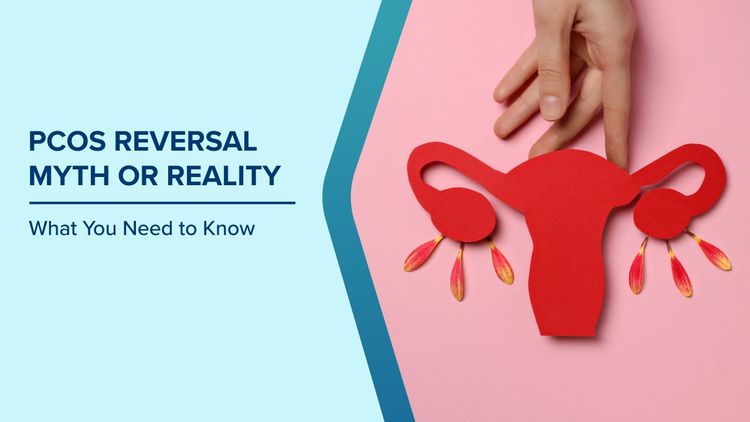 PCOS Reversal Myth or Reality