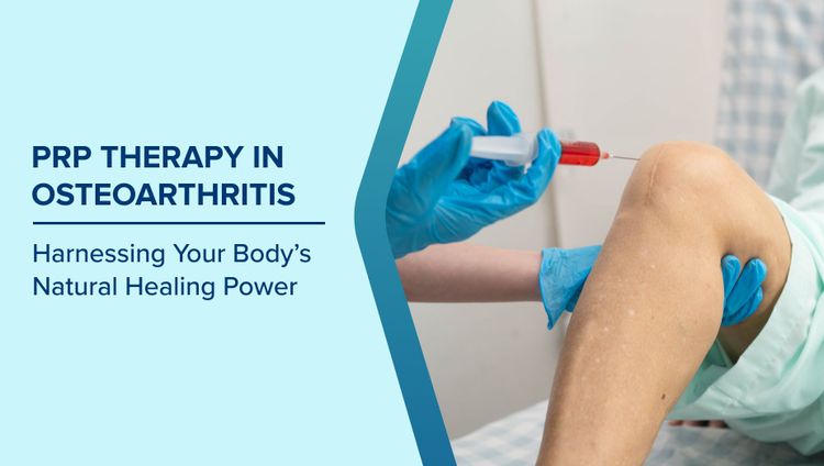 How Does PRP Help in Osteoarthritis