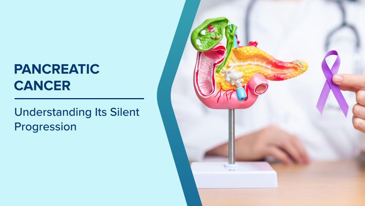 How Pancreatic Cancer Spreads