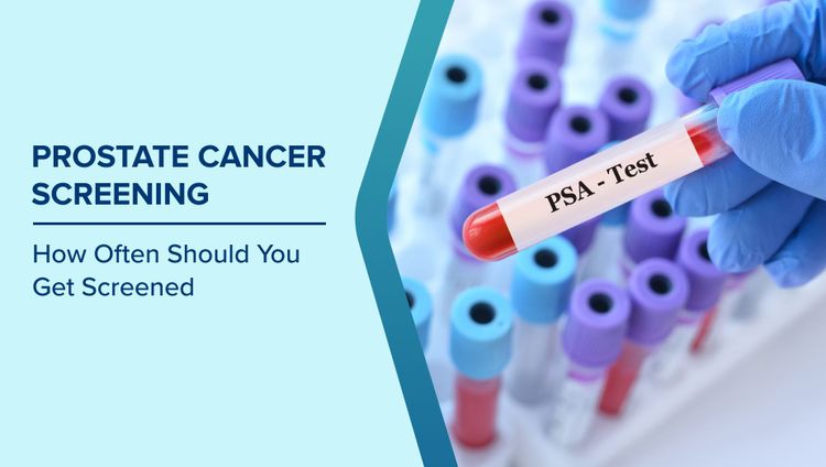 Prostate Cancer Screening
