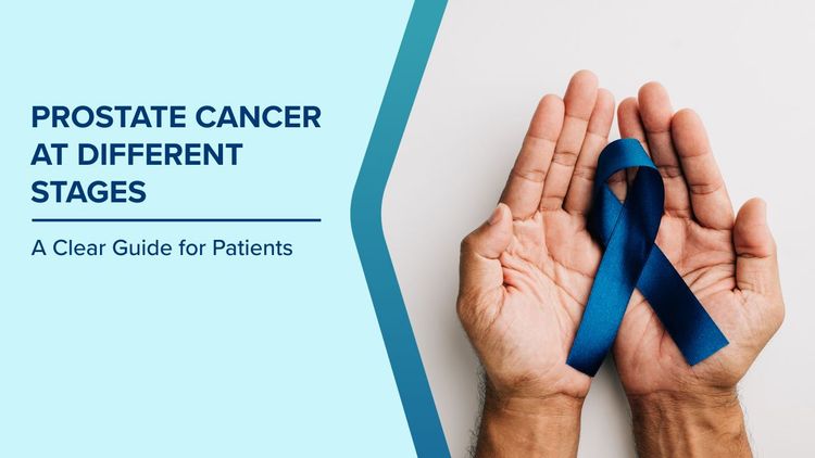 Prostate Cancer Stages
