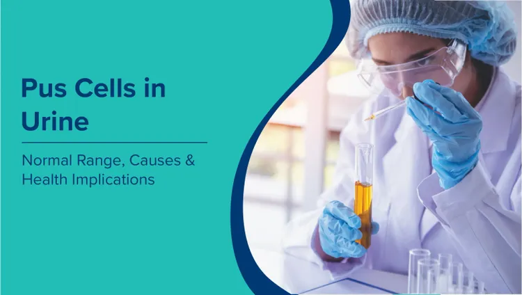 मूत्र में मवाद कोशिकाएं (Pus Cells in Urine in Hindi): सामान्य सीमा, कारण और स्वास्थ्य संबंधी प्रभाव