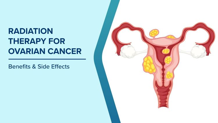 Benefits of Radiation in Recurrent Ovarian Cancer​
