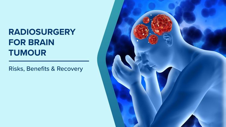 Radiosurgery for Brain Tumour Treatment