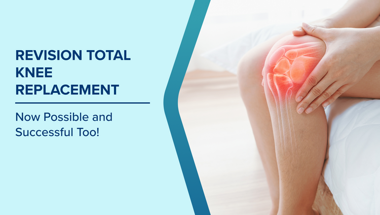 Revision Total Knee Replacement
