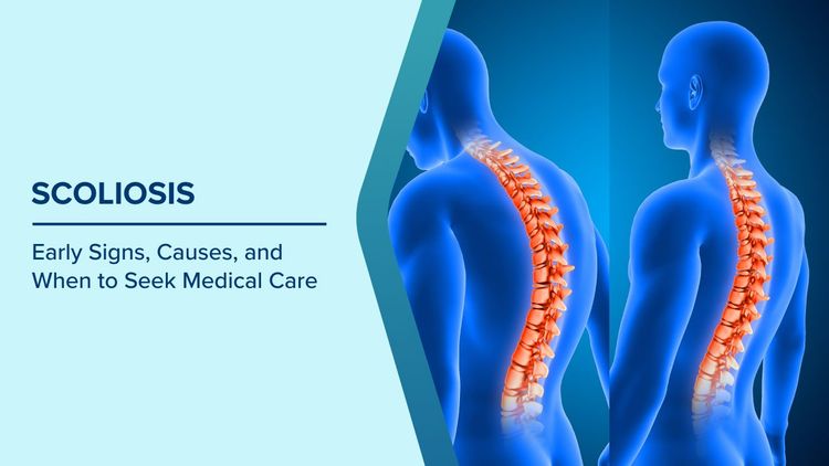 Early Signs of Scoliosis
