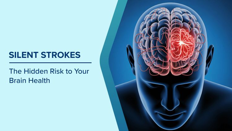 What is a Silent Stroke
