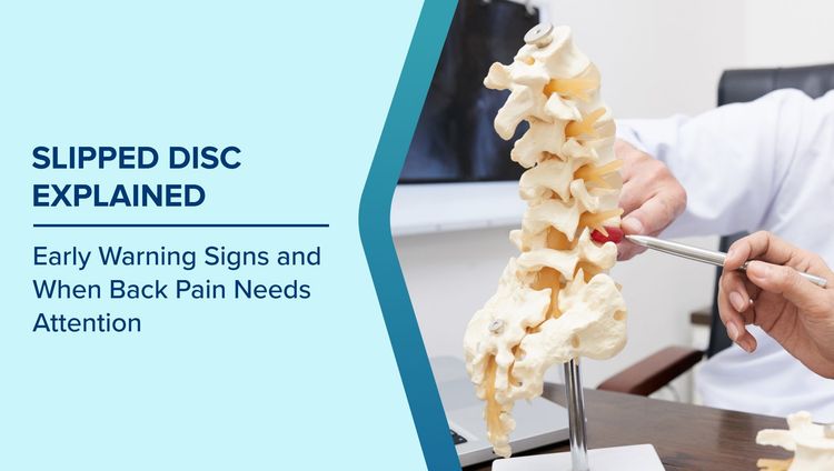 Slipped Disc Warning Signs
