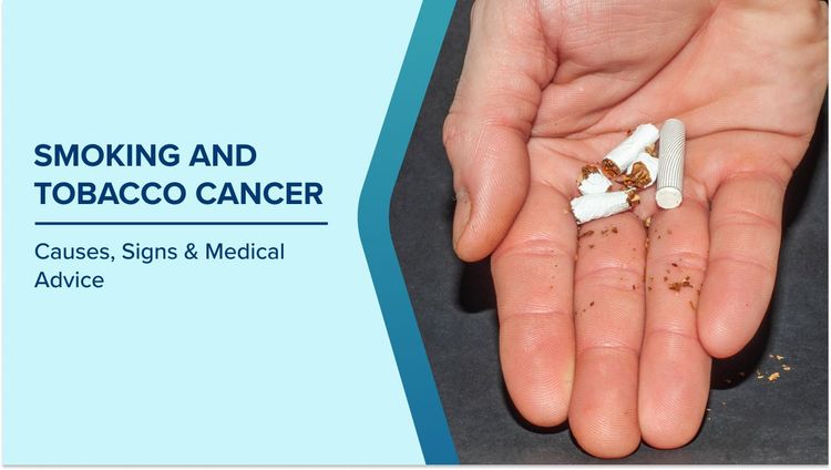 How Tobacco Causes Cancer