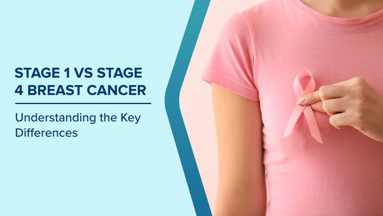 Stage 1 vs Stage 4 Breast Cancer 