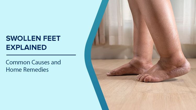 Causes of Swelling in Feet
