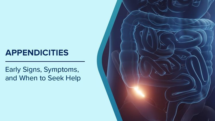 Symptoms of Appendicities
