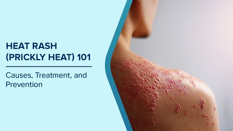 Symptoms of  Heat Rash