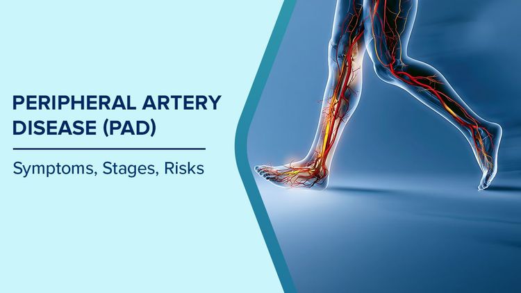 Symptoms of Peripheral Artery Disease
