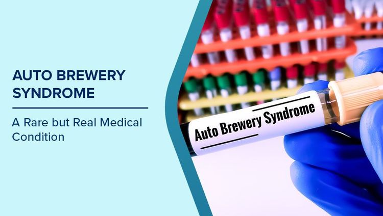 Auto Brewery Syndrome Symptoms