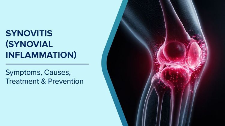 Synovitis Symptoms
