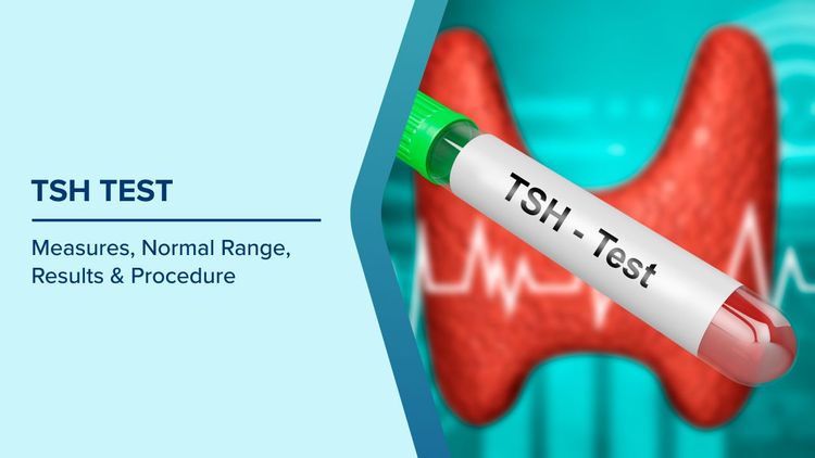 Thyroid TSH Test