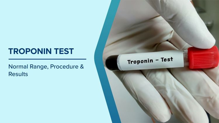 Troponin Test Normal Ranges