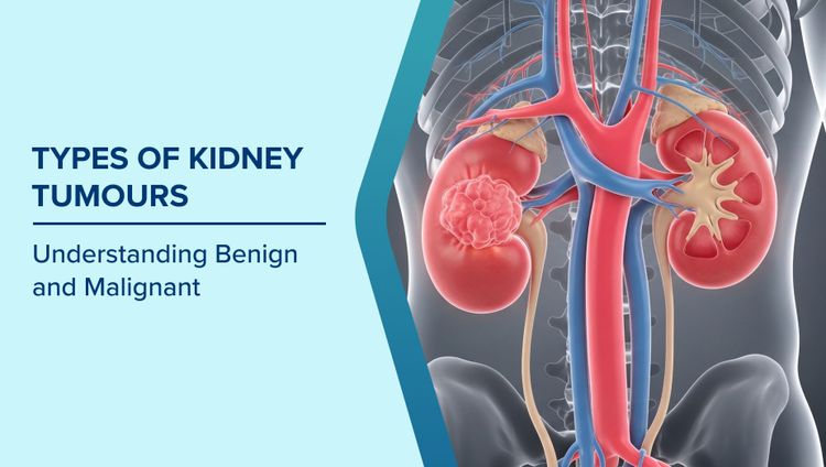 Types of Kidney Tumours