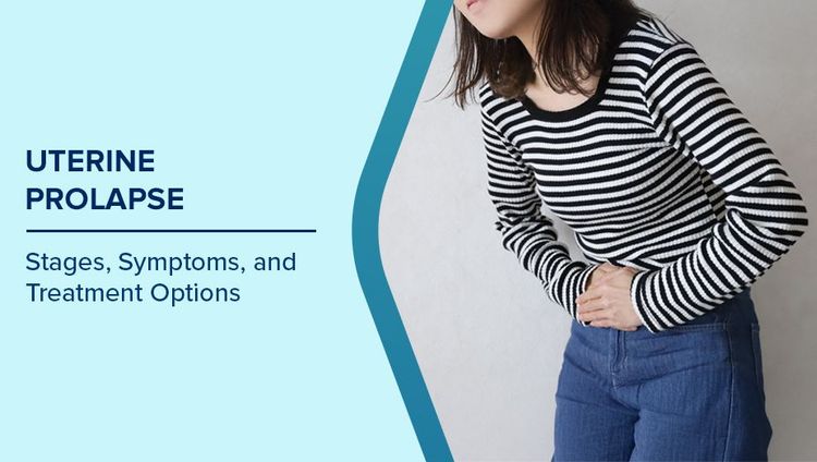 Uterine Prolapse Stages