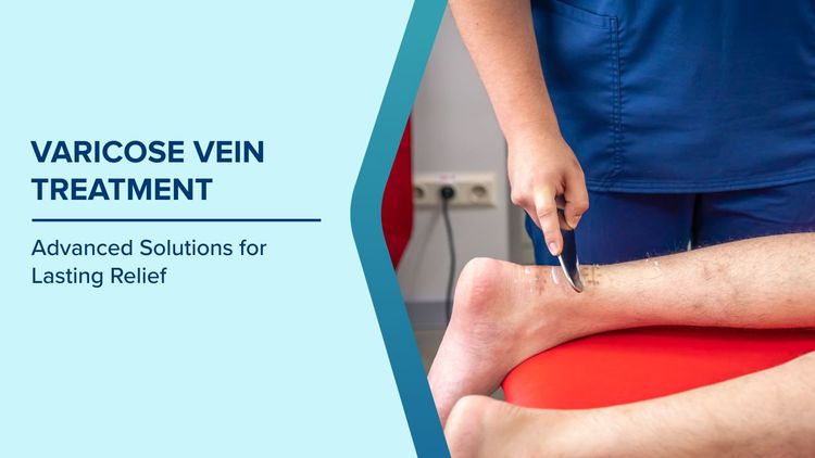 Why Varicose Veins Worsen Over Time