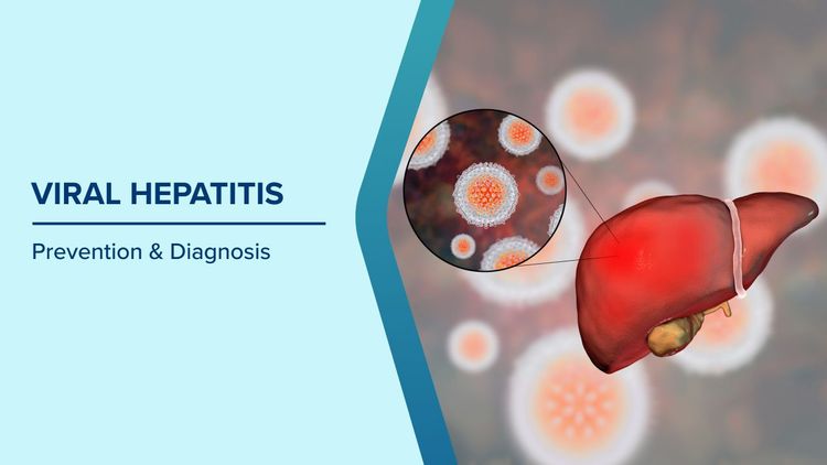 How Is Viral Hepatitis Prevented