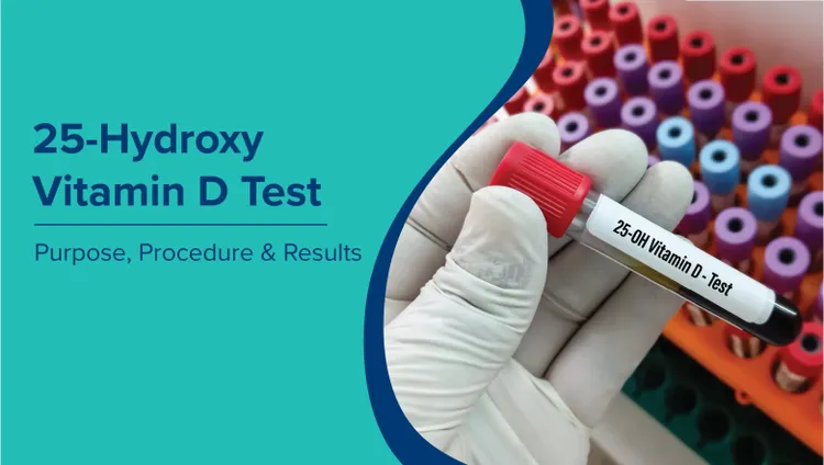 25-हाइड्रॉक्सी विटामिन डी परीक्षण (Vitamin D 25 Hydroxy Test in Hindi): उद्देश्य, प्रक्रिया और परिणाम