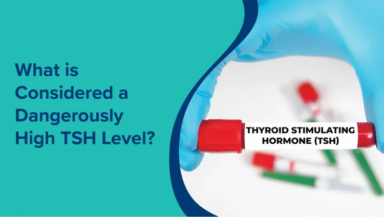 खतरनाक रूप से उच्च टीएसएच स्तर क्या माना जाता है? (What is Considered a Dangerously High TSH Level in Hindi)