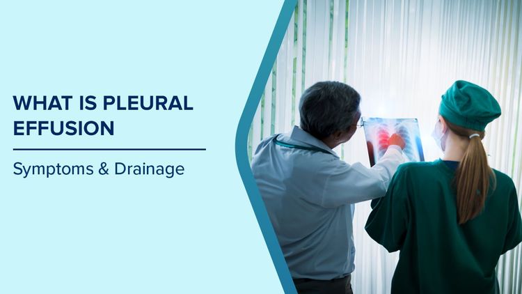 Pleural Effusion Symptoms