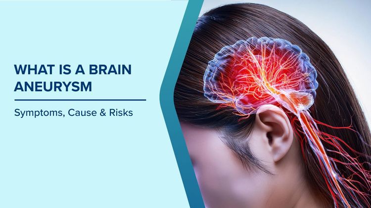 Brain Aneurysm Symptoms