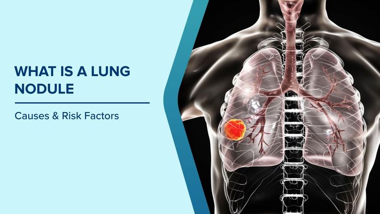 What Is a Lung Nodule