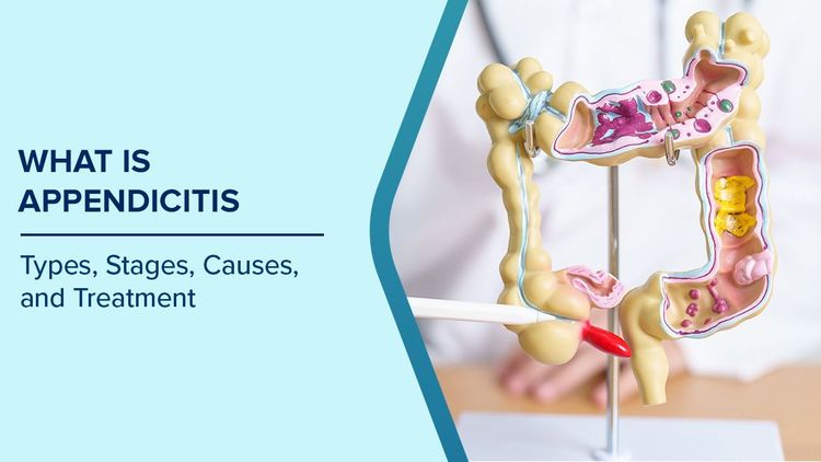 Appendicitis: Symptoms, Types, Causes, and Treatment Options | Max Hospital