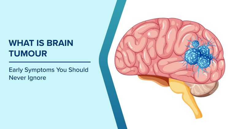 What is a Brain Tumour