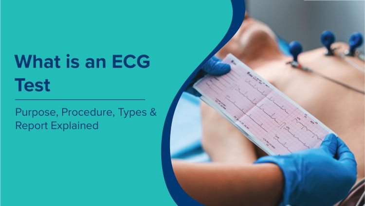 ईसीजी टेस्ट क्या है? (ECG Test in Hindi) उद्देश्य, प्रक्रिया, प्रकार और रिपोर्ट की व्याख्या