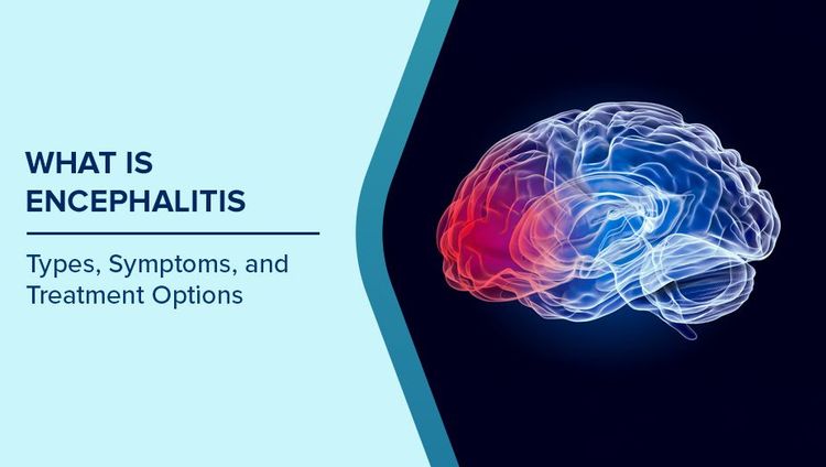Encephalitis Symptoms