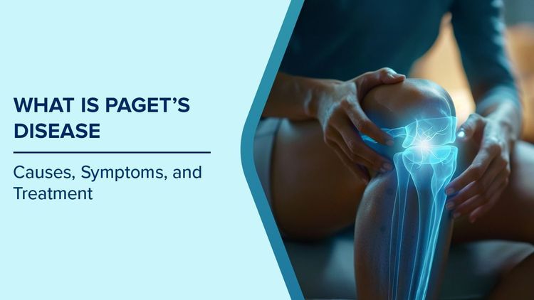 What is Paget’s Disease