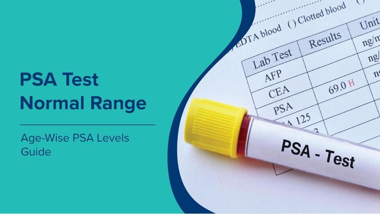 PSA Test Normal Range: Complete Guide to PSA Levels, Results & Prostate Cancer Screening
