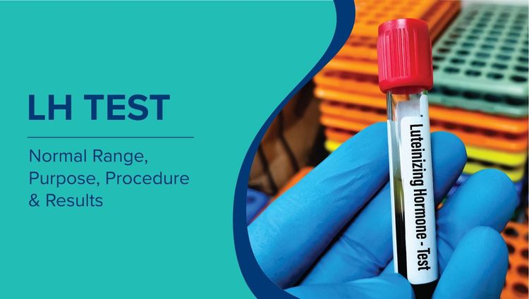 LH Test: Normal Range, Purpose, Procedure & Results