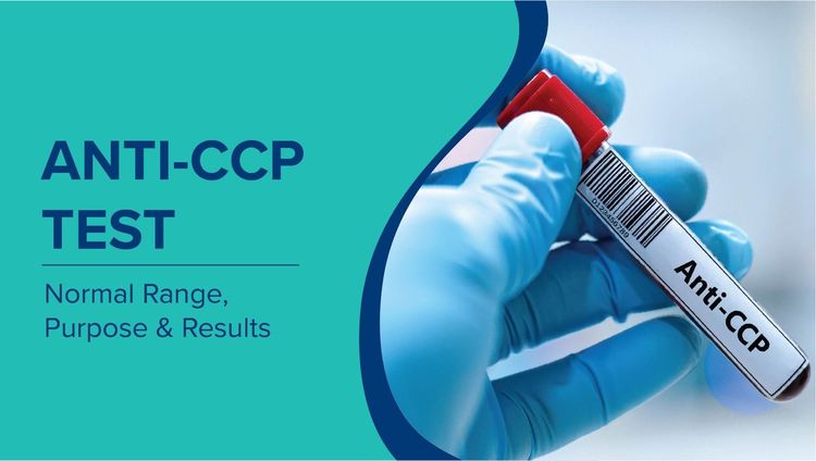 Anti-CCP Test: Normal Range, Purpose and What Your Results Mean for RA