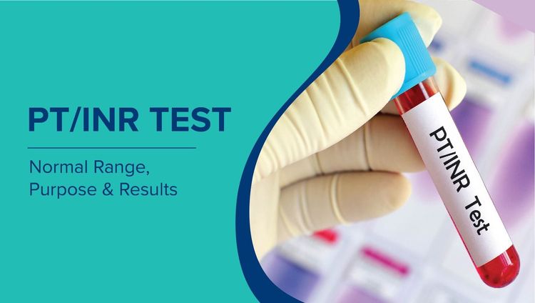 PT/INR Test: Normal Range, What Causes High and Low INR and results