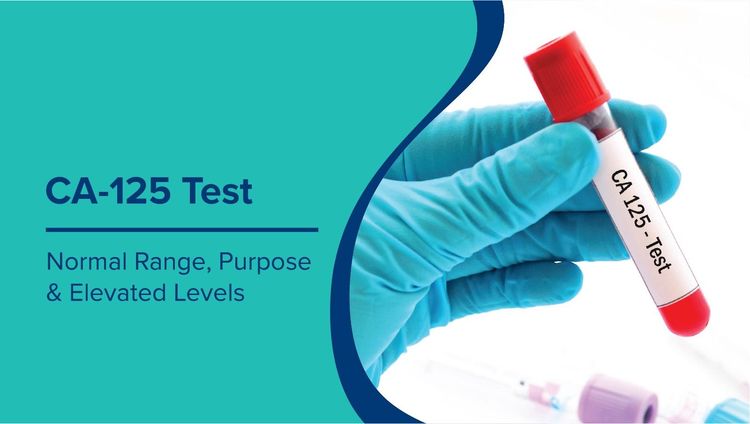 CA-125 Test: Normal Range, Purpose & Understanding Your Results