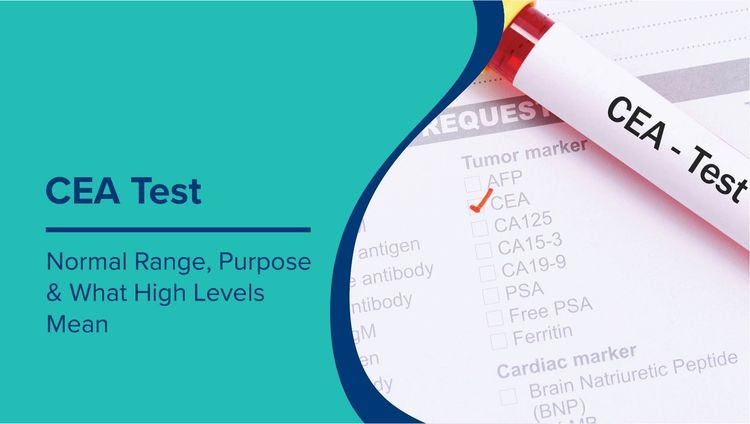 CEA Test: Normal Range, Purpose, and What Your Results Mean